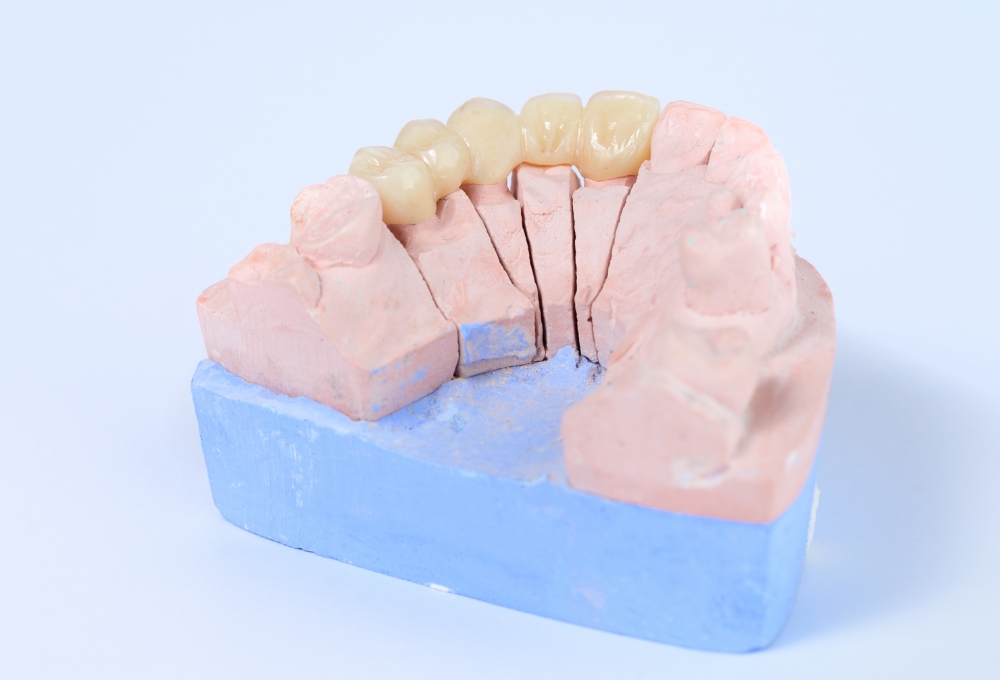 自然な白さと機能性を兼ね備えた、見た目にも美しい治療