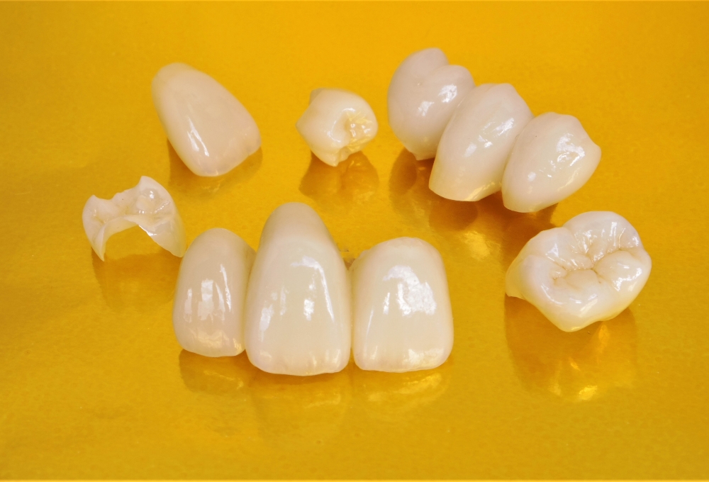 セラミックの種類